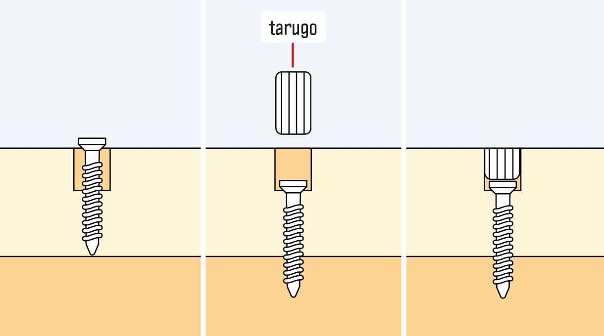 Enterrar los tornillos y poner el tarugo
